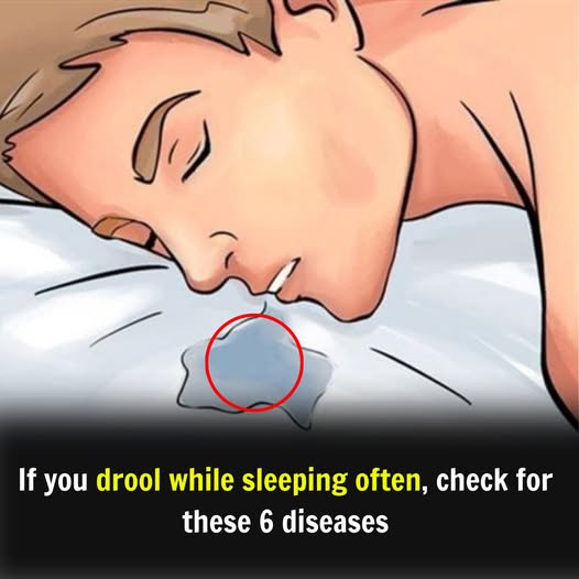Reasons You’re Drooling While You Sleep and What It Could Mean
