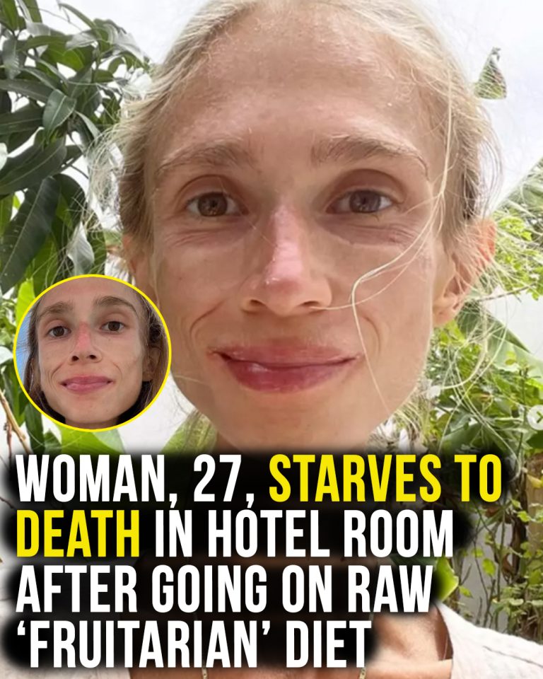 Woman, 27, starved to death in hotel room on raw ‘fruitarian’ diet