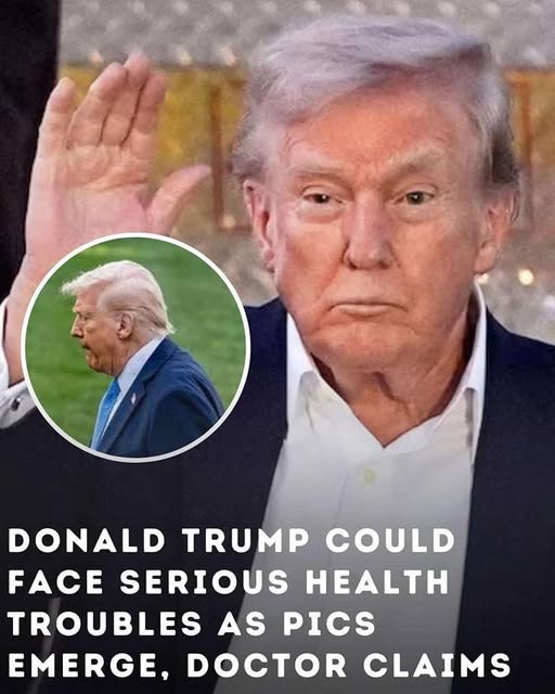 Doctor claims Donald Trump could face major health issues as new photos emerge