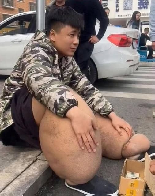 These are the consequences of sleeping with…See more