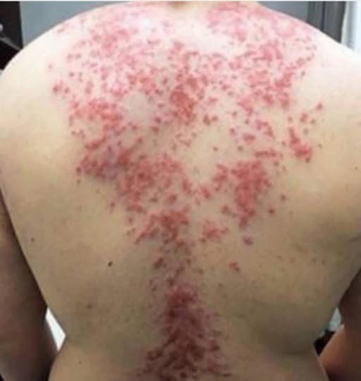 These are the consequences of sleeping with the…See more⬇️