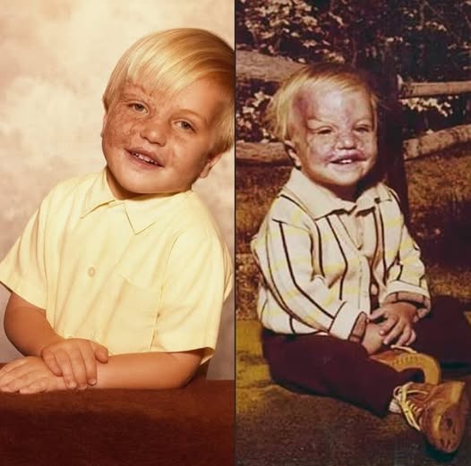 Against All Odds: Keith Edmonds’ Fight for Life