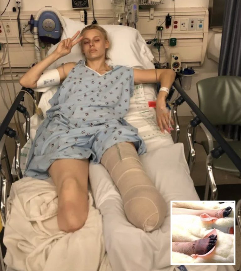 Woman Loses Her Legs Due To Common Household Product, Now She’s Warning Women Everywhere