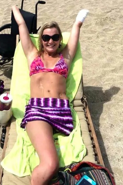Bikini pic on beach goes viral for optical illusion