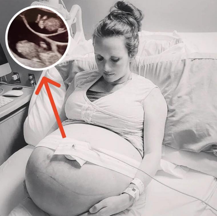 Nurses’ Blood Runs Cold The Moment They See Pregnant Mom’s Ultrasound