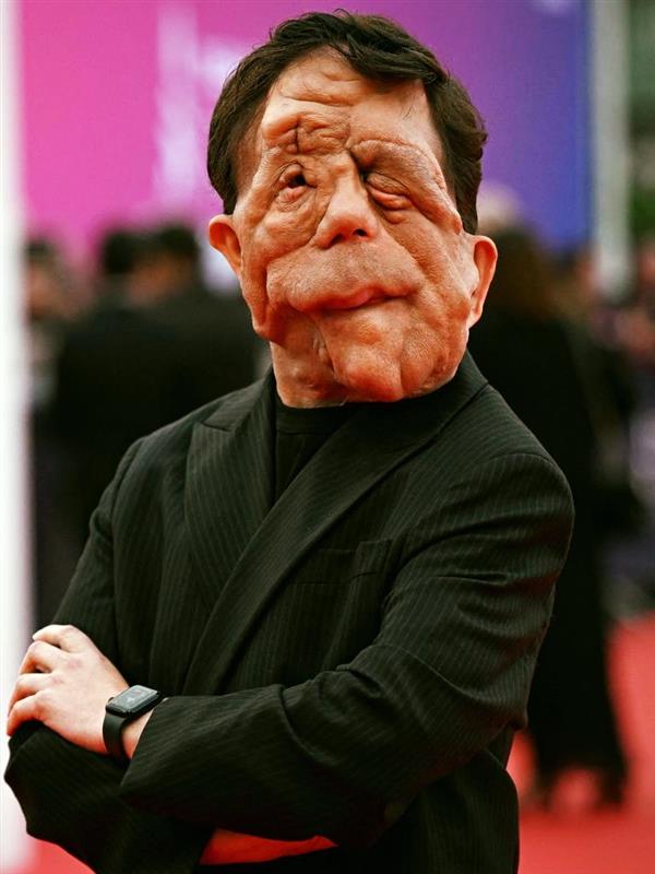 The incredible story of actor Adam Pearson: He’s an inspiration to millions