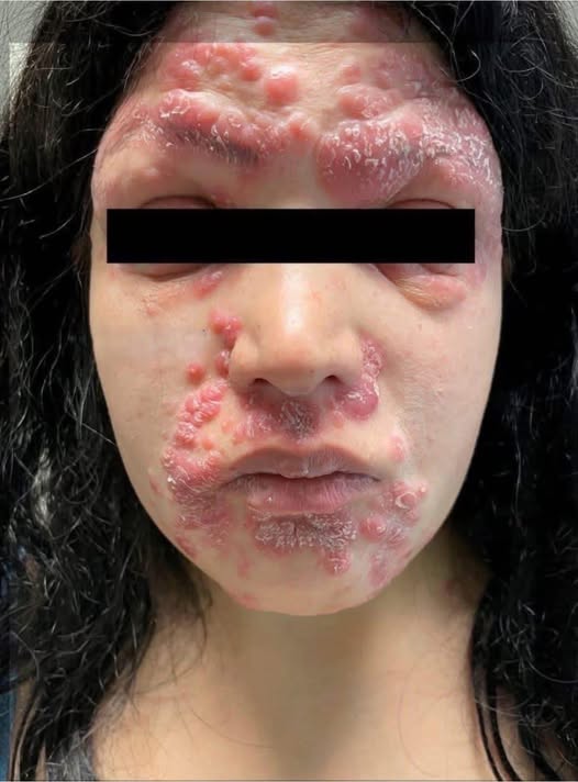 These are the consequences of sleeping with …👀