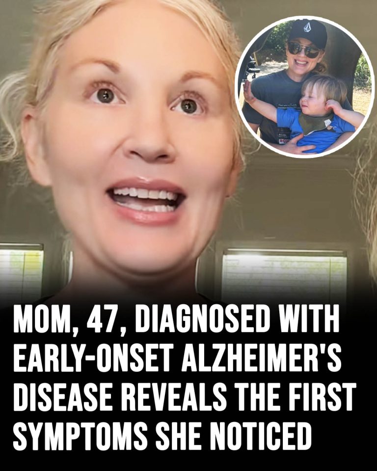 Mom, 47, diagnosed with early-onset Alzheimer’s disease reveals the first symptoms she noticed