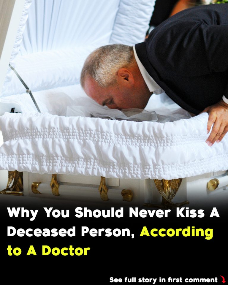 Doctor explains why you should never kiss a deceased person