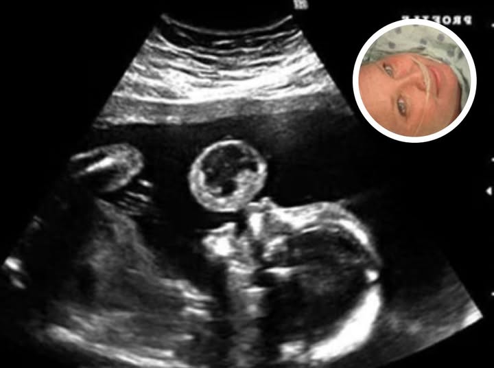 The Ultrasound That Left Doctors Frozen