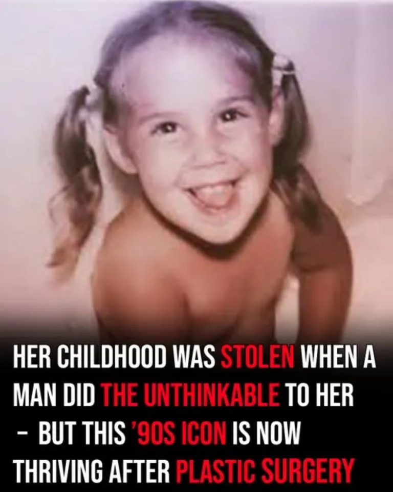 A man took away her childhood, but this ’90s icon is now thriving following plastic surgery