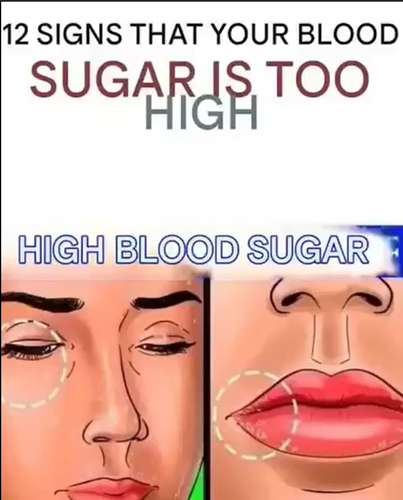 12 Key Indicators of High Blood Sugar and How to Manage Them Early