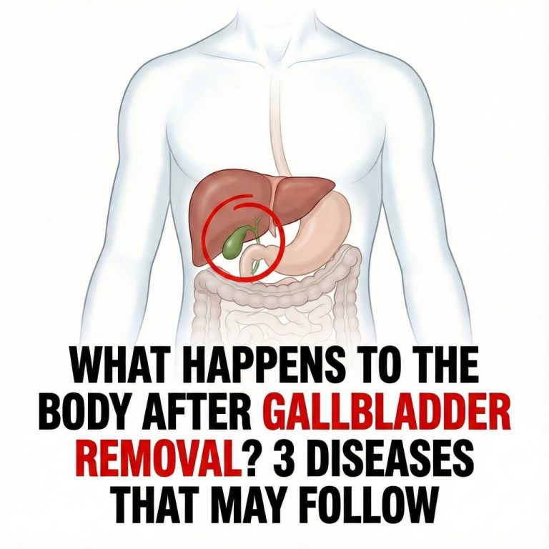 What happens to your body after gallbladder is removed