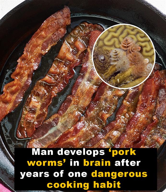 Man develops ‘pork worms’ after years of one specific cooking habit