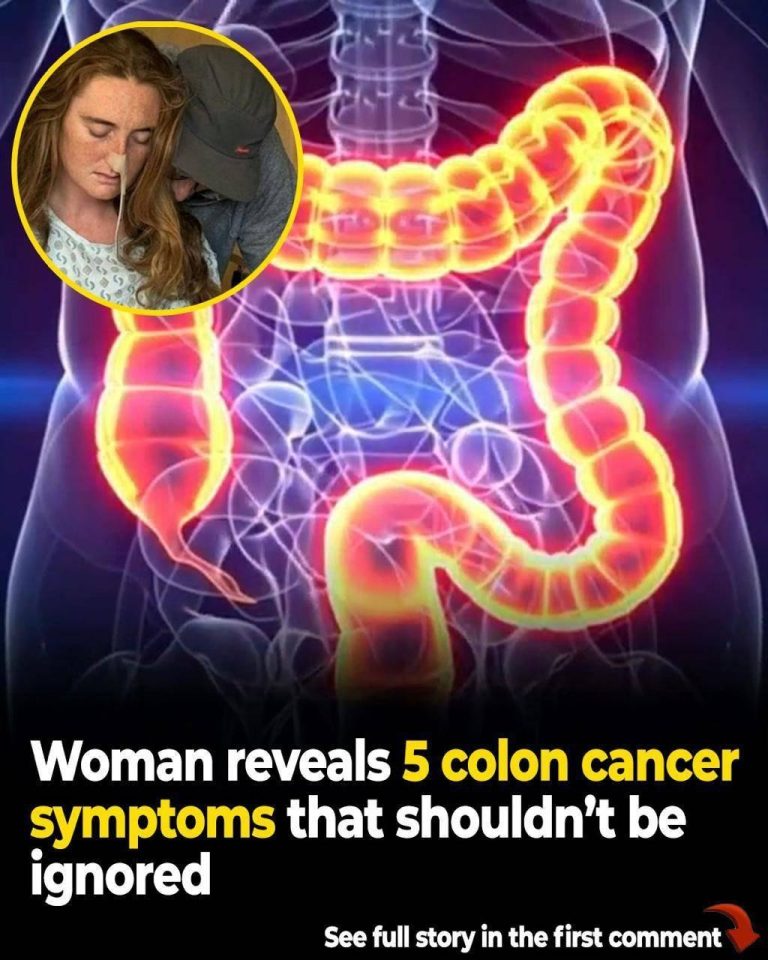 Woman reveals five colon cancer symptoms that should not be ignored