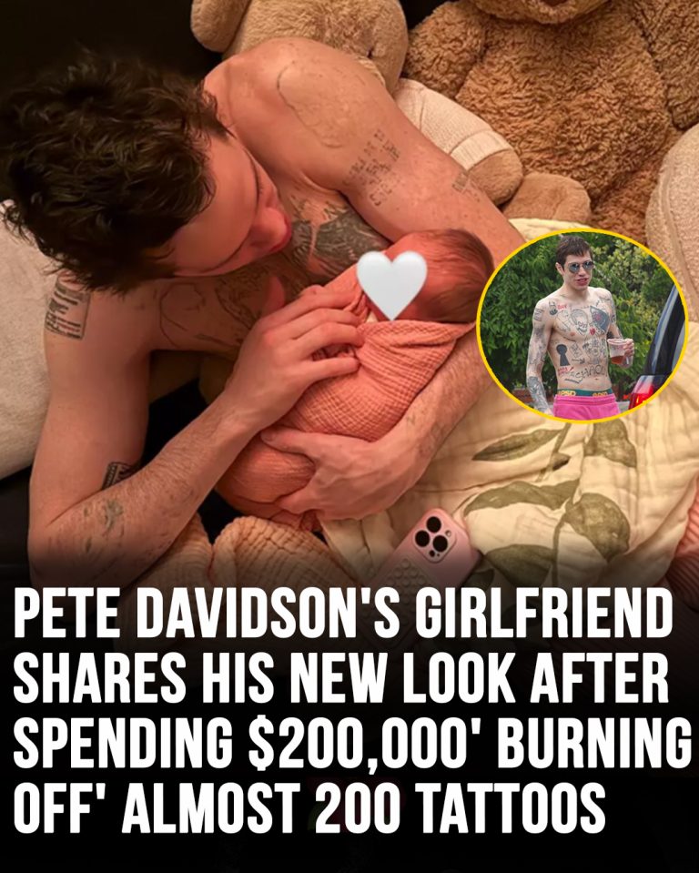 Pete Davidson’s girlfriend shares his new look after he spent $200,000 ‘burning off’ nearly 200 tattoos