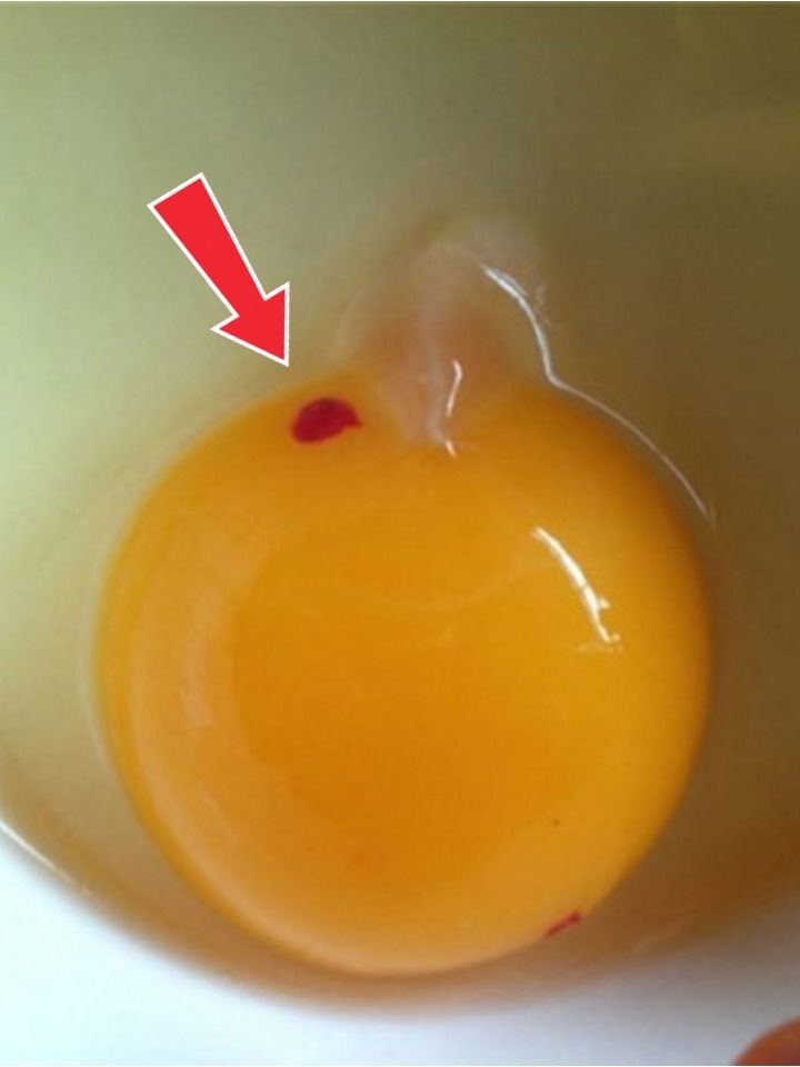 What Red Spots in Eggs Really Mean and Whether They Are Safe to Eat