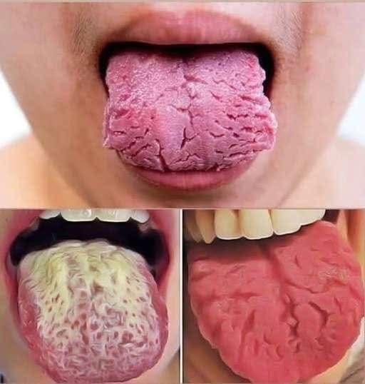 These Are the Consequences of Sleeping With the Signs Your Tongue Is Trying to Warn You About