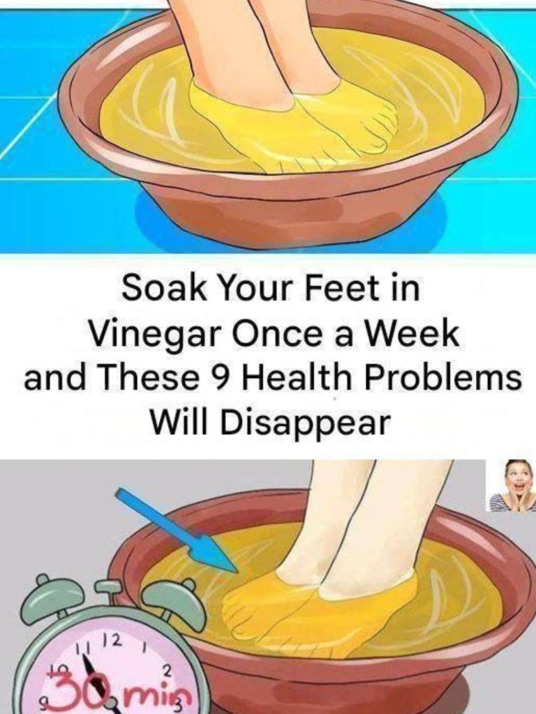 Soak Your Feet in Vinegar Once a Week and Watch These 9 Health Problems Disappear