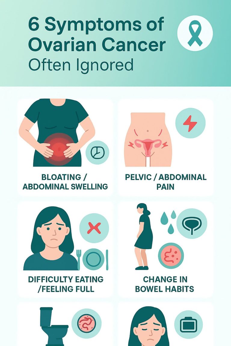 6 Often Overlooked Symptoms of Ovarian Cancer