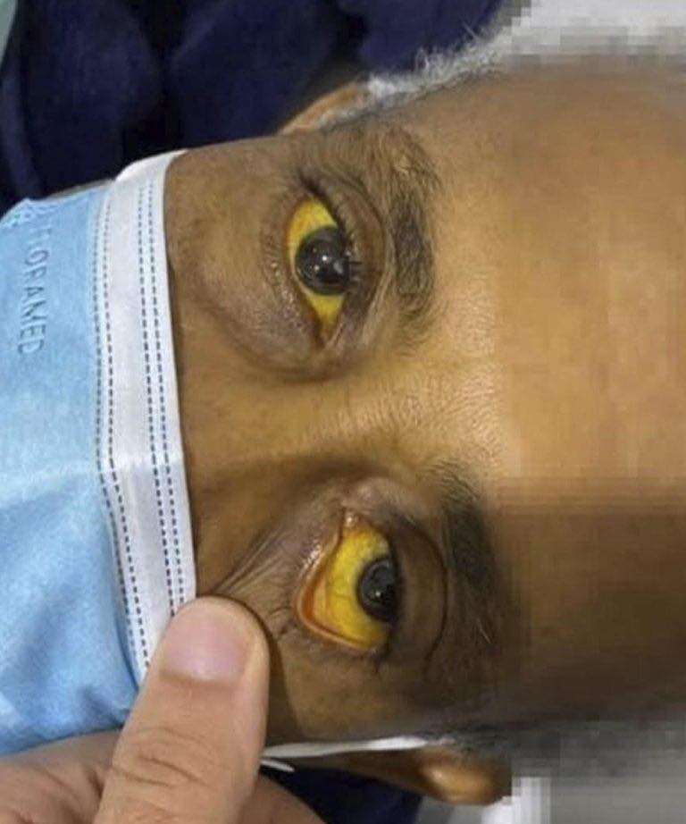 These are the consequences of sleeping with…