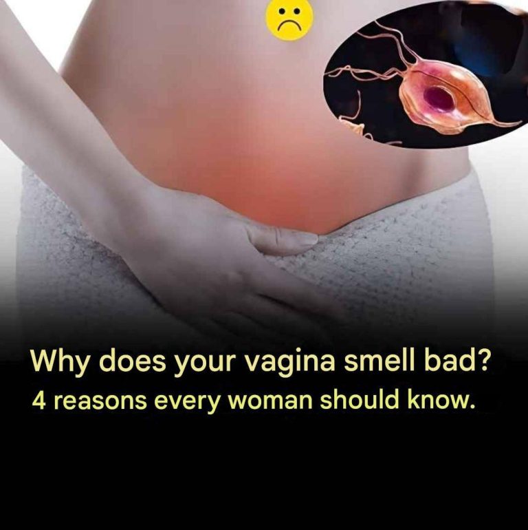 Why does your vagina smell bad? 4 reasons every woman should know.