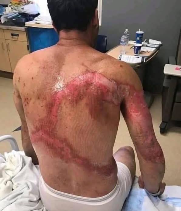 Be careful! These are the consequences of sleeping with the…