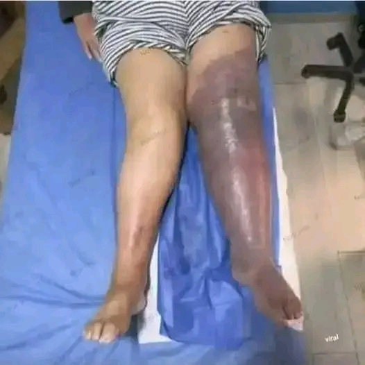 These are the consequences of sleeping with a…See more