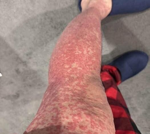 These are the consequences of sleeping with, See it?