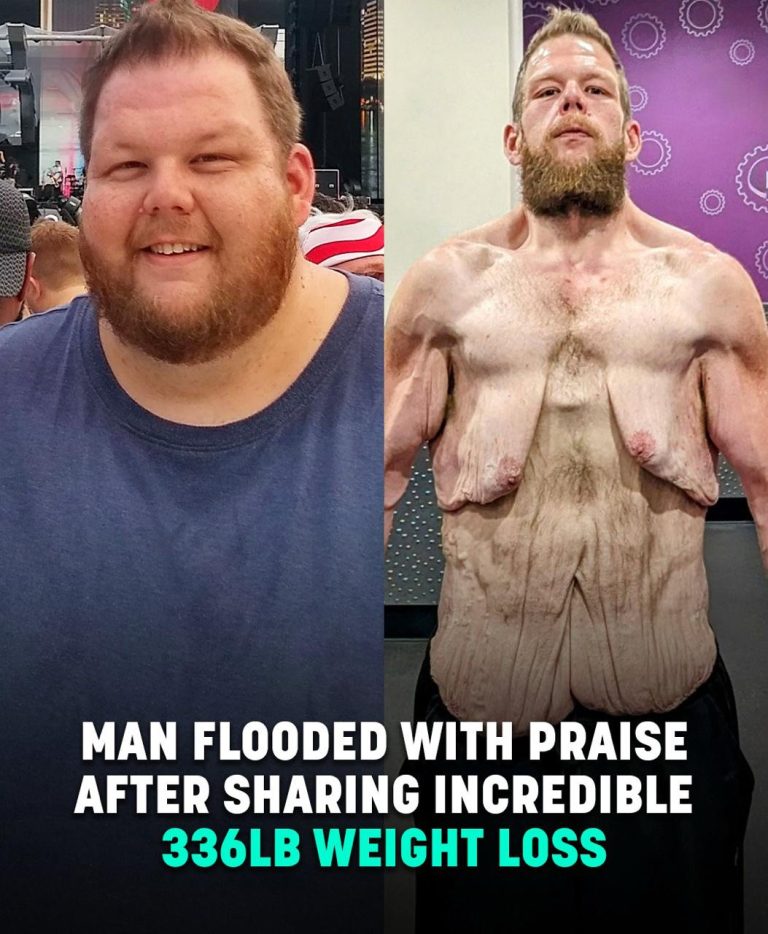 Social media users are applauding a man after he successfully lost 360 pounds.