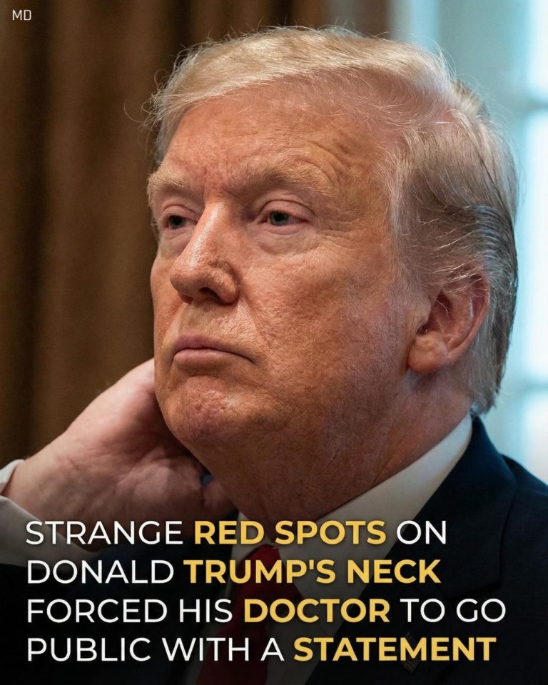 Doctor Addresses Questions About Donald Trump’s Appearance at Recent Event