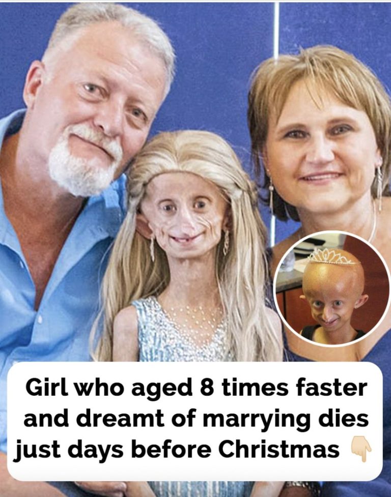 South African Girl Living With Progeria Passes Away, Remembered for Her Inspiring Spirit
