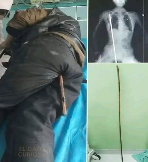 Young Man Hospitalized After Police Custody Incident: Understanding the Response, Investigation, and Community Concerns