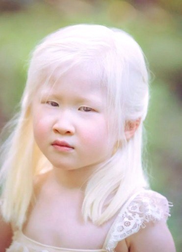 Xueli Abbing’s Journey: From Early Struggles to the Runway