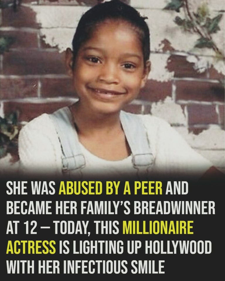 Her Smile Was Radiant — But She Kept a Deep Secret for Years