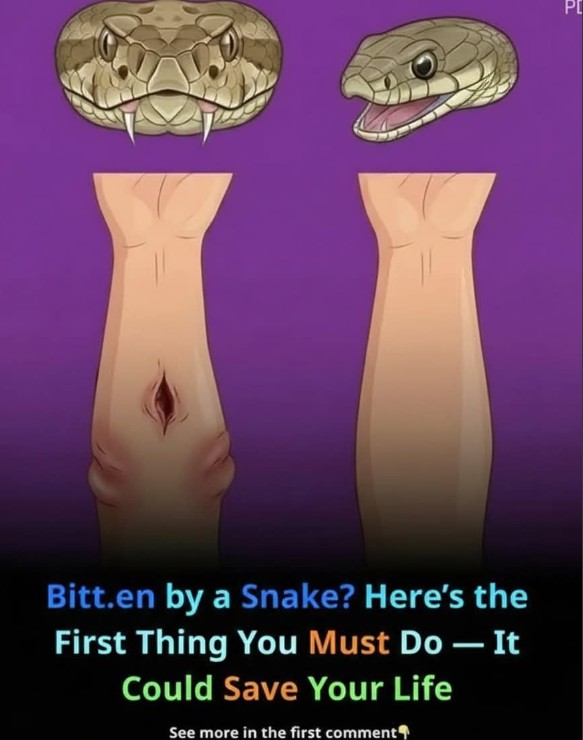 How to Handle a Snakebite: Essential First Aid Steps That Could Help