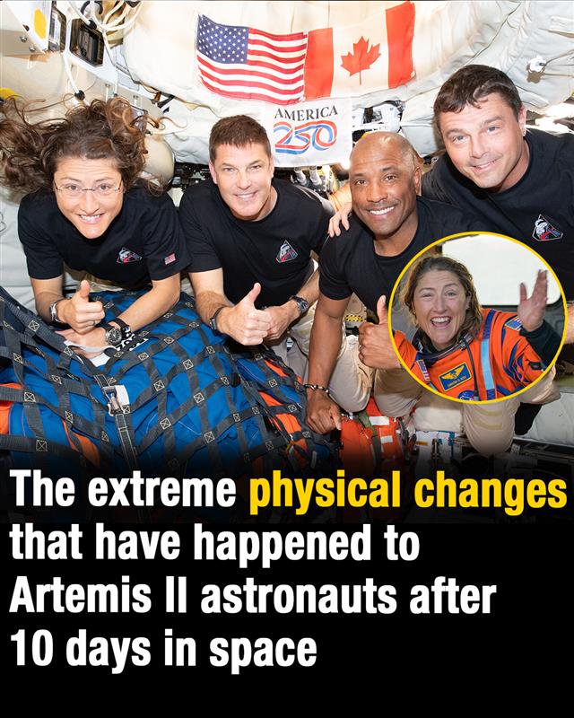 The physical changes that have happened to Artemis II crew after 10 days in space