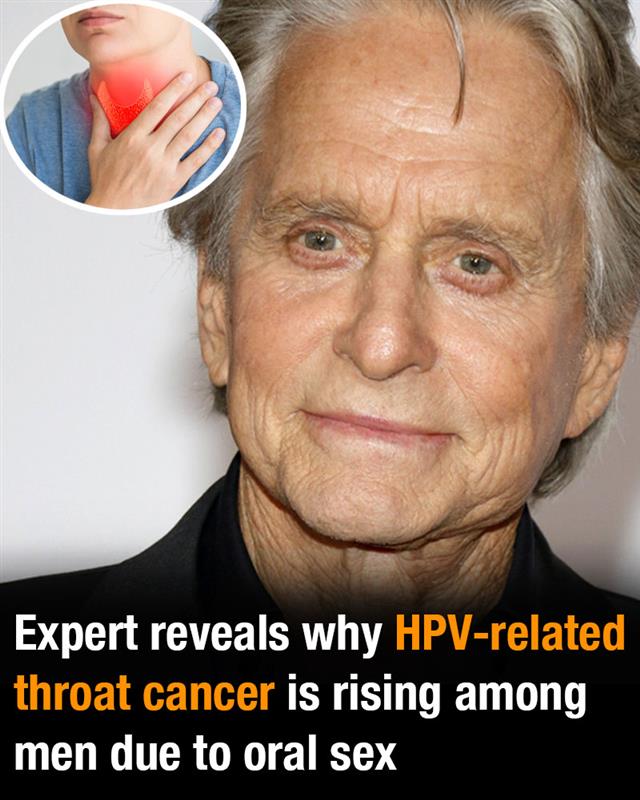 Expert reveals why HPV-related throat cancer is rising among men due to oral sex