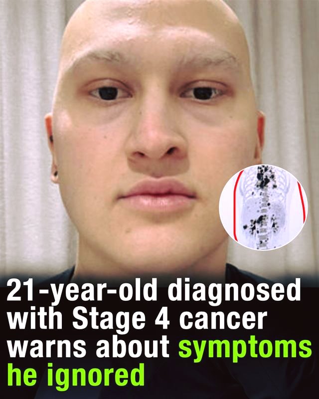 21-Year-Old Shares Cancer Diagnosis and Reflects on Early Symptoms He Missed