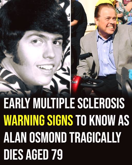 Early Warning Signs of Multiple Sclerosis to Be Aware Of Following Alan Osmond’s Passing at 76