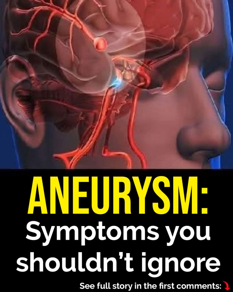 12 early warning signs of an aneurysm you shouldn’t ignore