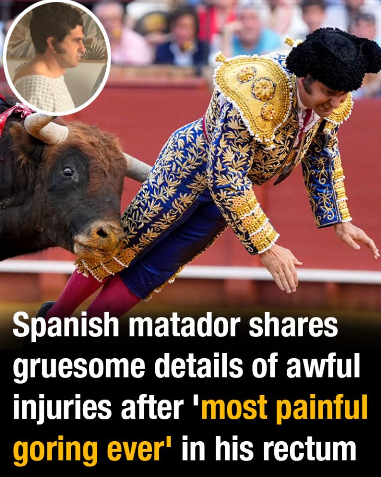 Spanish matador shares gruesome details of awful injuries after ‘most painful goring ever’
