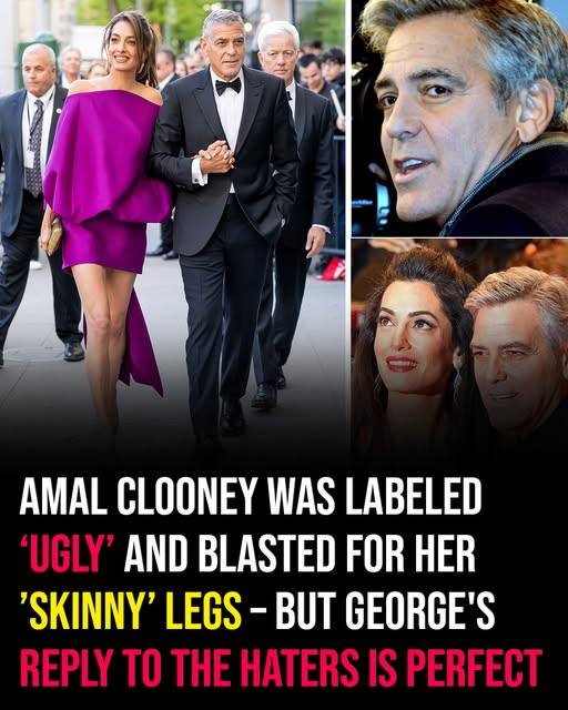 Amal Clooney Labelled ‘Ugly’ and Blasted for Her Skinny Legs — George’s Response is Perfect