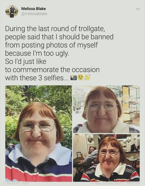 Search results for: Woman once bullied for her looks takes a selfie every day for a year, inspiring thousands