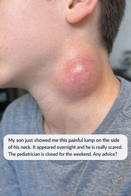 My son suddenly noticed a painful lump on the side of his neck that appeared overnight, and he’s quite worried. The pediatrician is closed for the weekend—any advice?